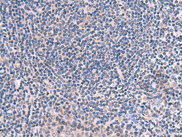 SCCPDH Polyclonal Antibody (E-AB-52948)