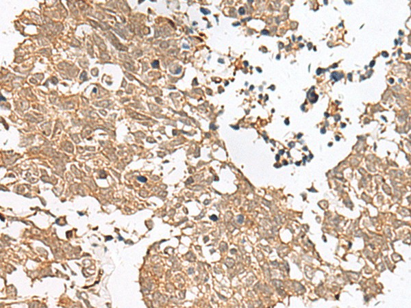 GRASP Polyclonal Antibody (E-AB-19905)
