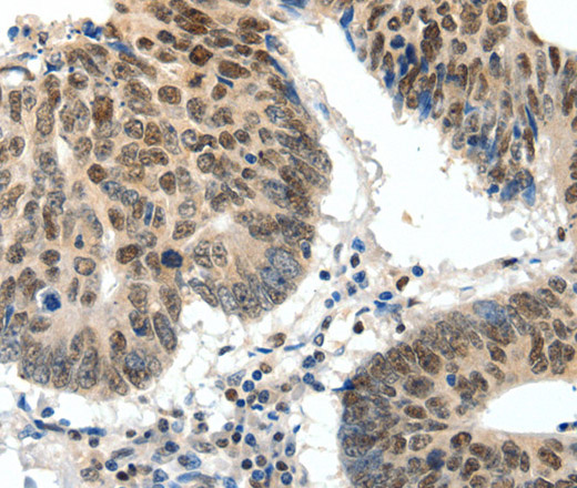 TOP2A Polyclonal Antibody (E-AB-12664)