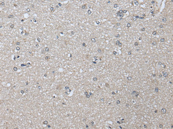 PRAME Polyclonal Antibody (E-AB-52200)