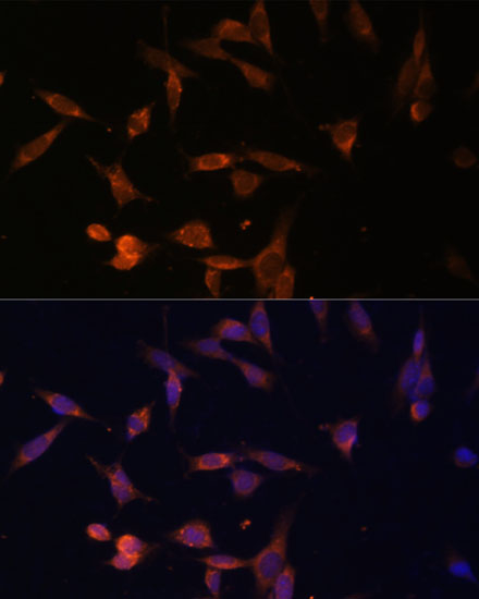 UMPS Polyclonal Antibody (E-AB-66035)
