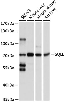 SQLE Polyclonal Antibody (E-AB-63722)