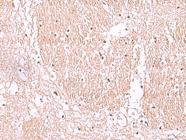 RIC8A Polyclonal Antibody (E-AB-19028)