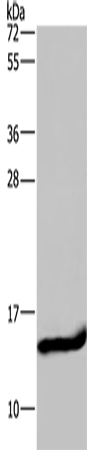 FABP2 Polyclonal Antibody (E-AB-13341)