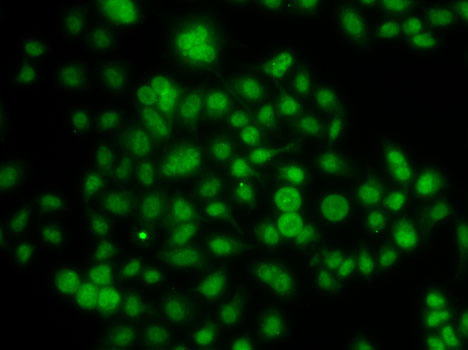 ATOH7 Polyclonal Antibody (E-AB-61610)