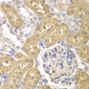 AKR1A1 Polyclonal Antibody (E-AB-64729)