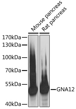 GNA12 Polyclonal Antibody (E-AB-90662)