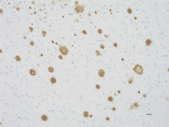 Anti-β-Amyloid, 17-24 Antibody (Previously Covance catalog# SIG-39200) (800708)