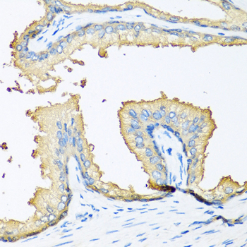 NOV Polyclonal Antibody (E-AB-62845)