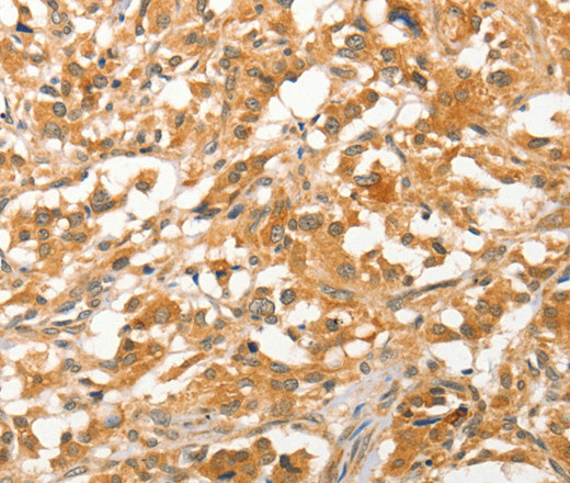 APTX Polyclonal Antibody (E-AB-14594)