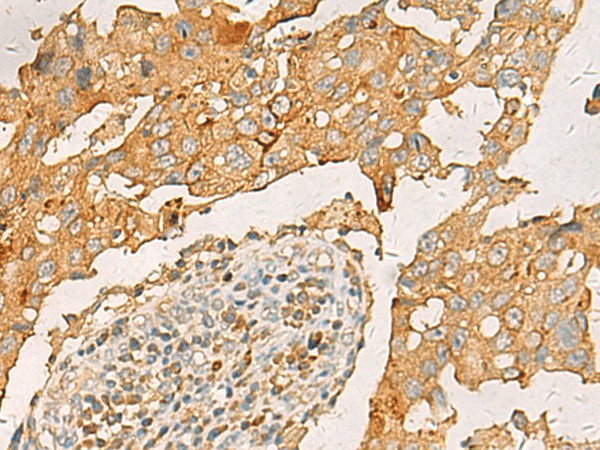CXCL1 Polyclonal Antibody (E-AB-19462)
