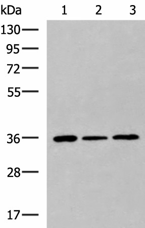 KHK Polyclonal Antibody (E-AB-52096)