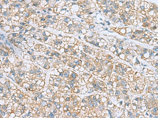 NANP Polyclonal Antibody (E-AB-53114)
