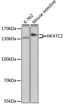 NFATC2 Polyclonal Antibody (E-AB-60842)