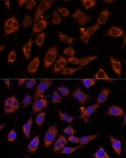 GFPT2 Polyclonal Antibody (E-AB-65288)