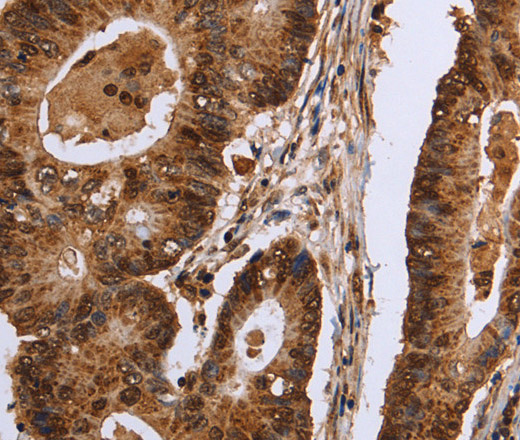 EXTL3 Polyclonal Antibody (E-AB-11204)