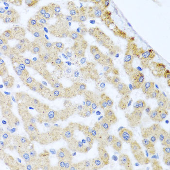 CETN3 Polyclonal Antibody (E-AB-62036)