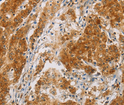 CENPE Polyclonal Antibody (E-AB-16335)