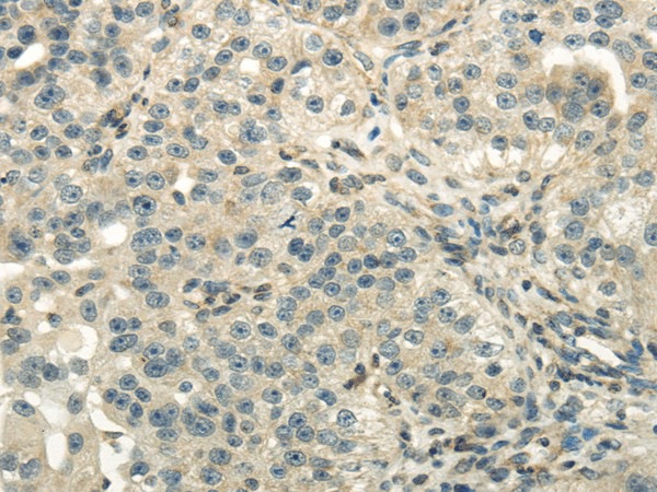 DLAT Polyclonal Antibody (E-AB-17216)
