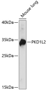 PKD1L2 Polyclonal Antibody (E-AB-65162)