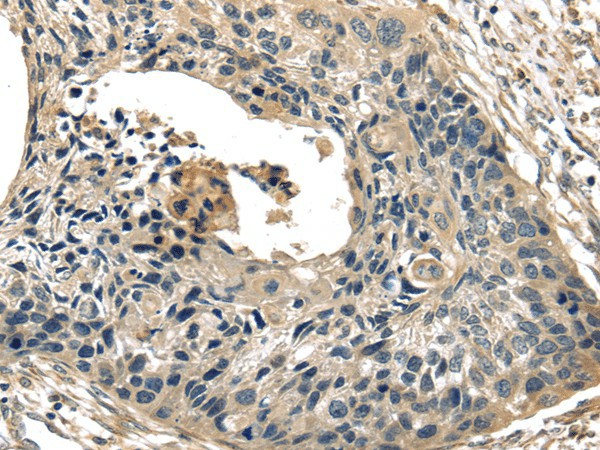 TXNIP Polyclonal Antibody (E-AB-17496)