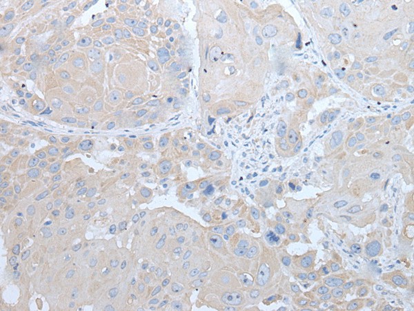 IFNB1 Polyclonal Antibody (E-AB-19507)