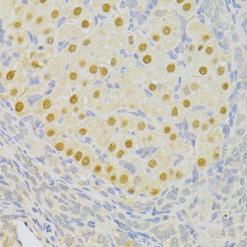 PFKFB3 Polyclonal Antibody (E-AB-67803)
