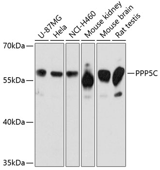 PPP5C Polyclonal Antibody (E-AB-64092)