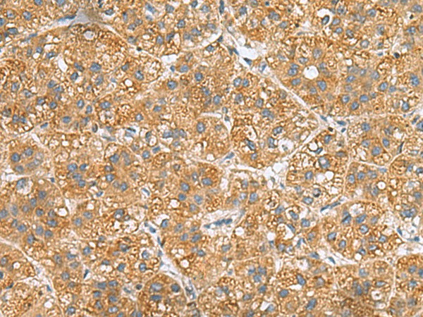 PPM1M Polyclonal Antibody (E-AB-53113)