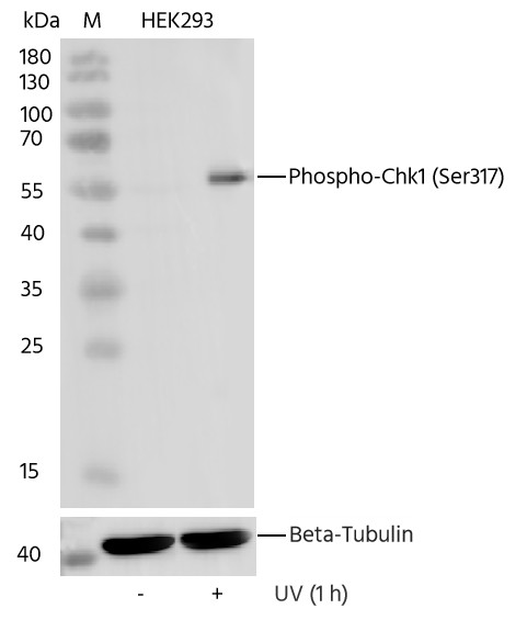 Recombinant Phospho-Chk1 (Ser317) Monoclonal Antibody (AN300380L)