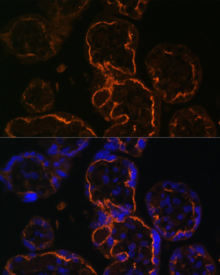 LDB3 Polyclonal Antibody (E-AB-61722)