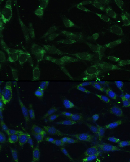 CAPN5 Polyclonal Antibody (E-AB-61695)