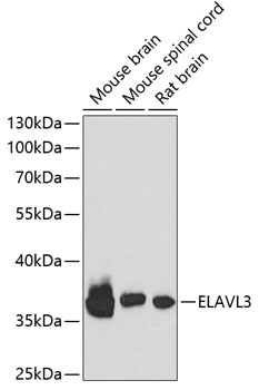 ELAVL3 Polyclonal Antibody (E-AB-62727)