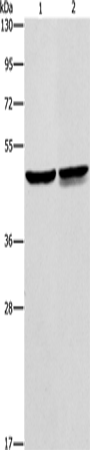 AMACR Polyclonal Antibody (E-AB-10127)