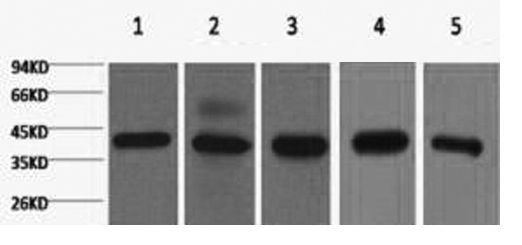 EIF4A1 Monoclonal Antibody (E-AB-22076)