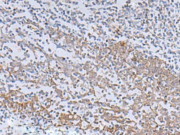 IL22RA2 Polyclonal Antibody (E-AB-52193)