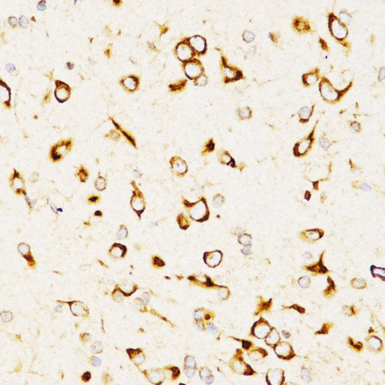 LAMP3 Polyclonal Antibody (E-AB-60794)