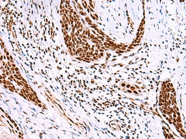 ISY1-RAB43 Polyclonal Antibody (E-AB-52047)