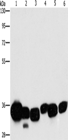 CBR1 Polyclonal Antibody (E-AB-14736)