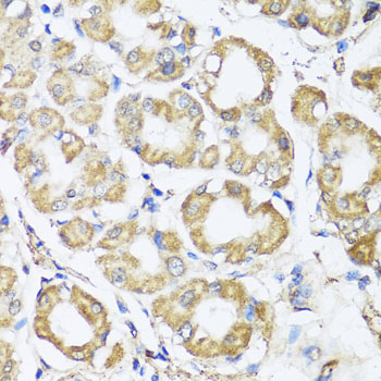 B9D1 Polyclonal Antibody (E-AB-62419)