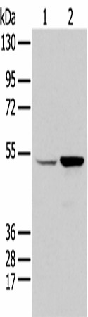 EGR2 Polyclonal Antibody (E-AB-53428)