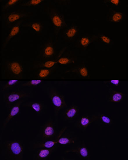 SRSF7 Polyclonal Antibody (E-AB-66923)