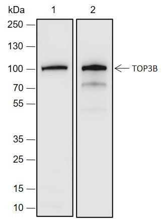 Recombinant TOP3B Monoclonal Antibody (AN301974L)
