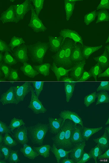 (KO Validated) PRMT6 Polyclonal Antibody (E-AB-63865)