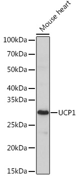 UCP1 Polyclonal Antibody (E-AB-93247)