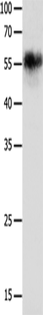 CHRNA3 Polyclonal Antibody (E-AB-15792)
