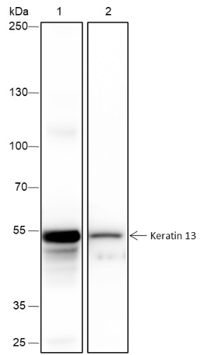 Recombinant Keratin 13 Monoclonal Antibody (AN301694L)