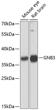 GNB3 Polyclonal Antibody (E-AB-62768)