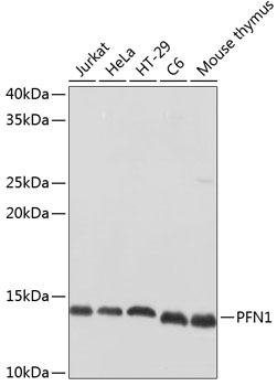 PFN1 Polyclonal Antibody (E-AB-60223)