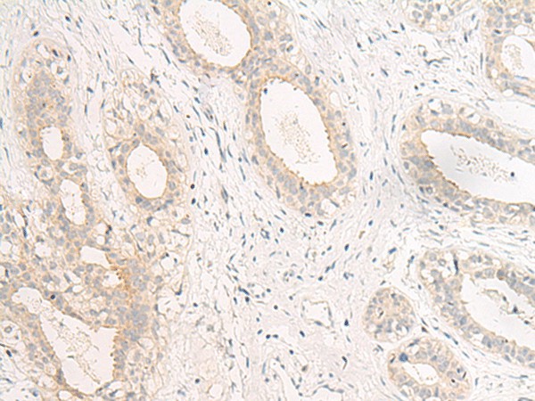 GPR157 Polyclonal Antibody (E-AB-19953)